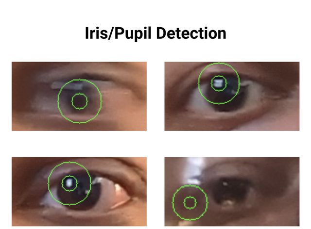 PupilSense: iris and pupil located in everyday photos